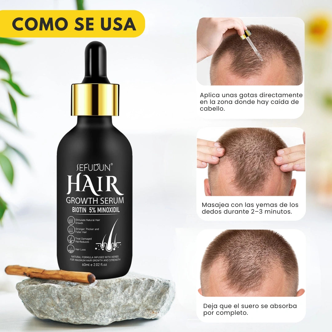 ULTRA FORTE MINOXIDIL + BIOTINA®